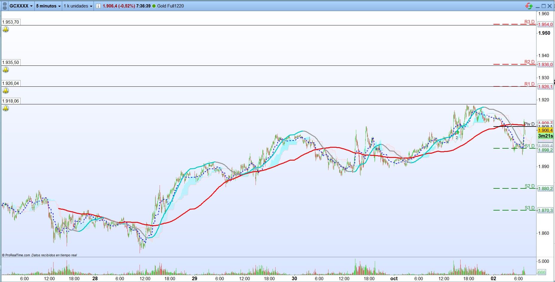 Oro: Análisis técnico de corto plazo. Scalping