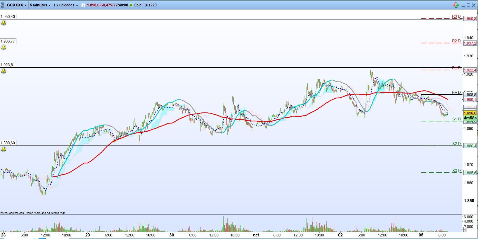 Oro: Análisis de operativa de corto plazo. Scalping