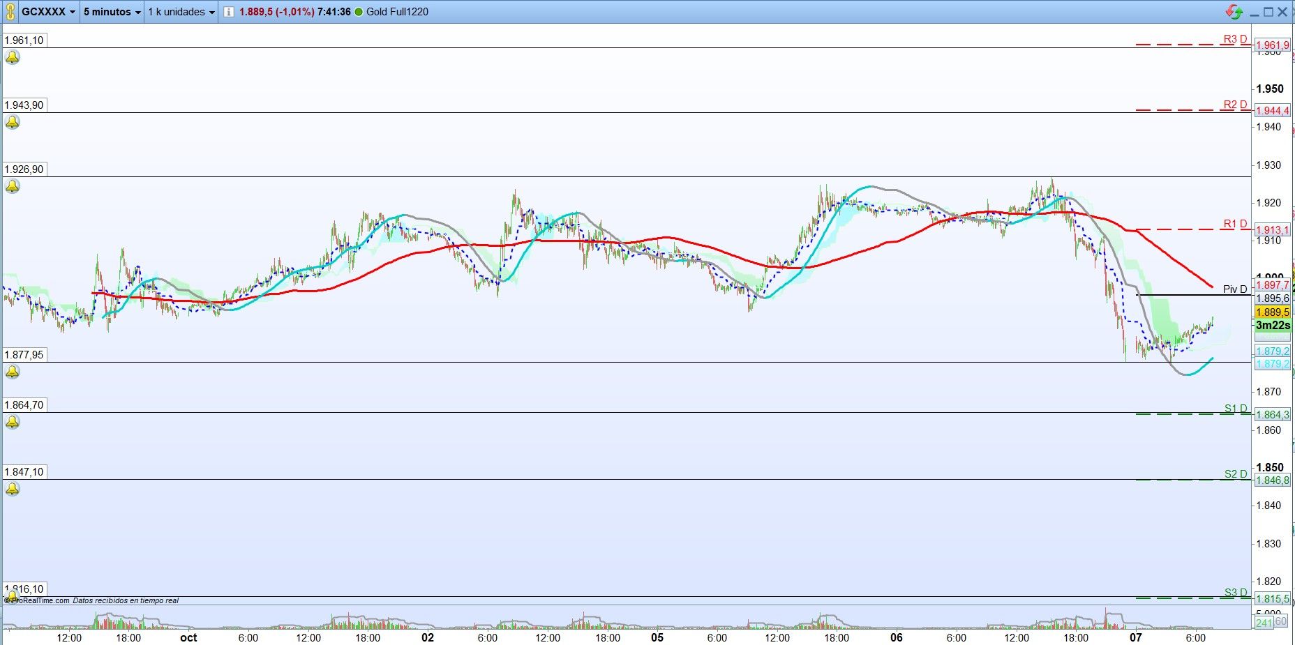 Oro: Análisis técnico de corto plazo. Scalping